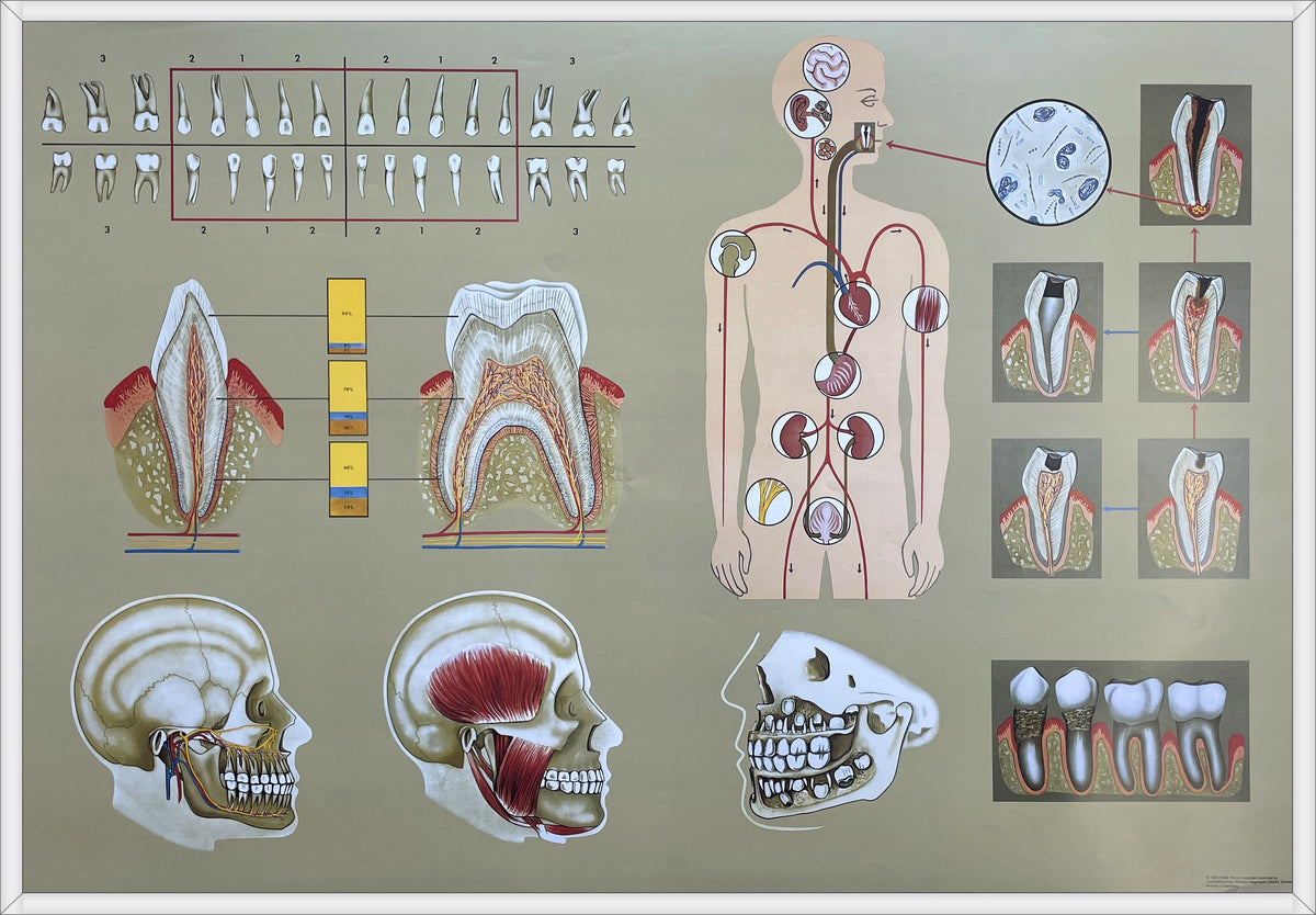 Lehrmitteltafel / Schulwandtafel Gesundes Gebiss
