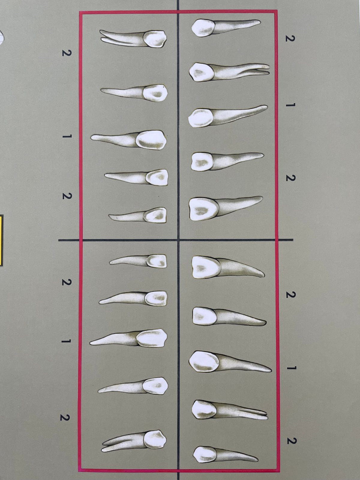 Lehrmitteltafel / Schulwandtafel Gesundes Gebiss Rechts